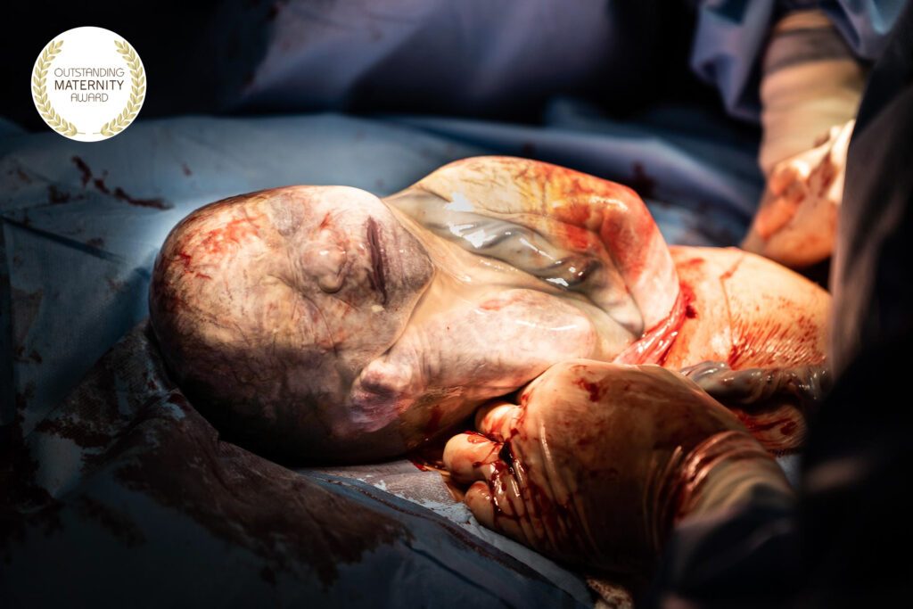 Fabio Moraes, childbirth photographer, reveals 5 tips for beginners.